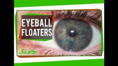Eyeball Floaters Explained